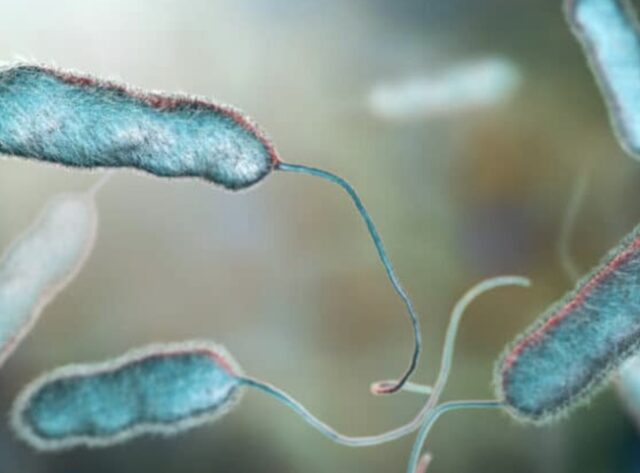legionella reggio emilia